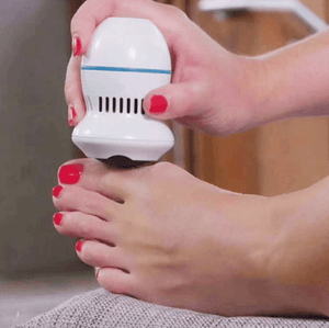 Callus Remover