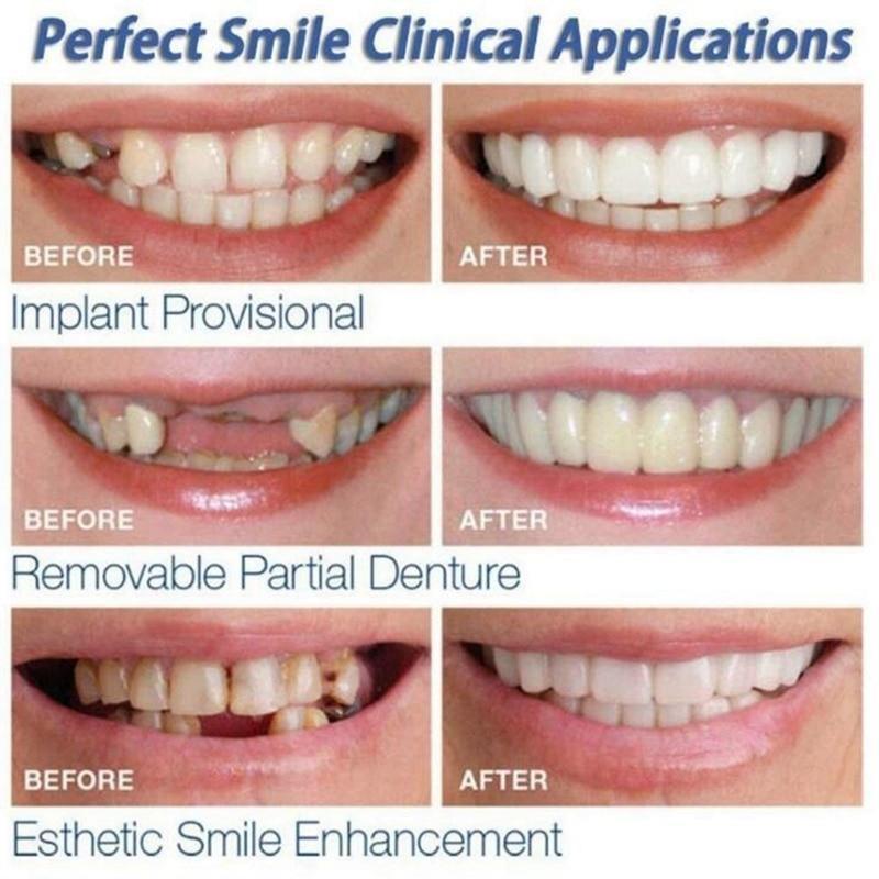 Magic Teeth Brace