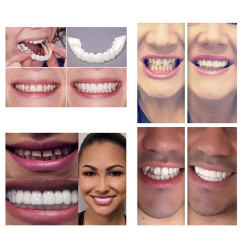 Magic Teeth Brace
